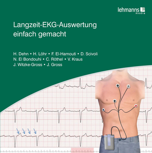 Langzeit-EKG-Auswertung