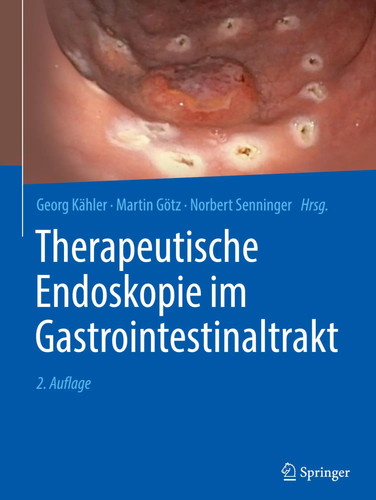 Therapeutische endoskopie - therapeutische, im