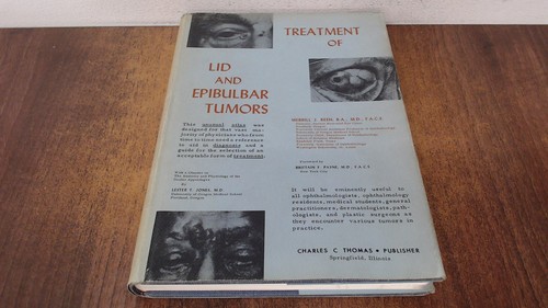 Treatment of lid and - treatment,