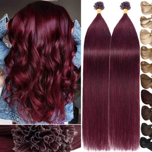 Bonding extension - bonding,
