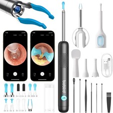 BEBIRD R1 Ultra Ohrenschmalz