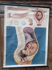 Vorgeburtliche Entwicklung Lehrtafel  Lehrmittel  Rollkarte  Plakat ~ Wandkarte