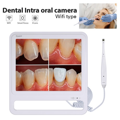 Dentale intraorale kamera - dentale,