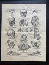 antike Grafik Medizin /