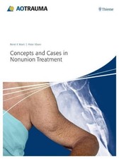 Concepts and Cases in Nonunion Treatment, René K Marti