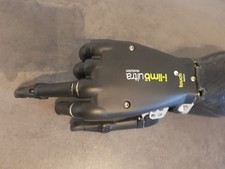 Össur i-Limb Ultra Touch Handprothese rechts Arm Prothese extra für behinderte 