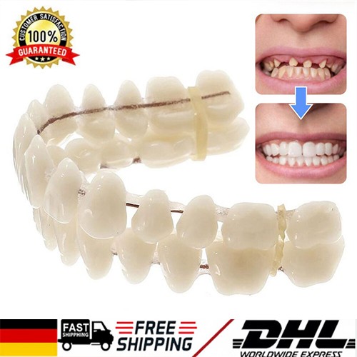 Snap veneers kosmetische - on,