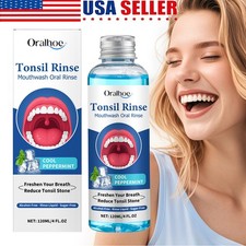Natural Tonsil Stone Remover