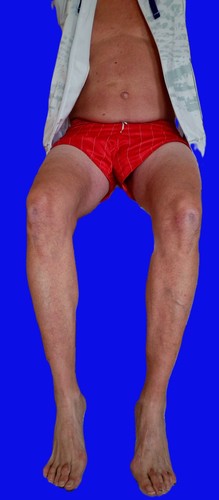 Adidas sprinter shorts - adidas,