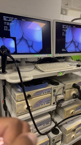 Olympus q145l colonoscope - olympus, cf-q145l