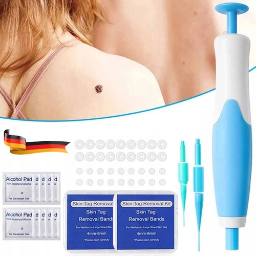 Stielwarzen entferner skin - entferner,