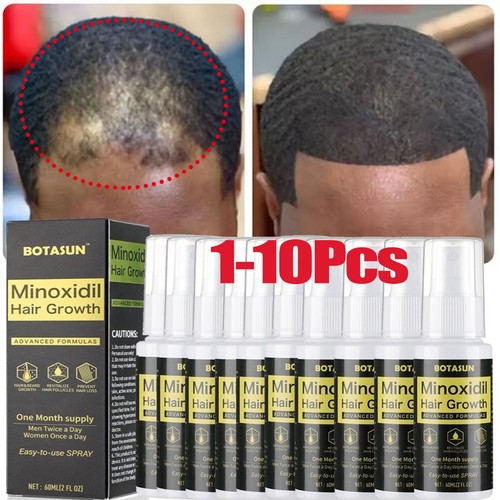Extra stärke minoxidil - extra,
