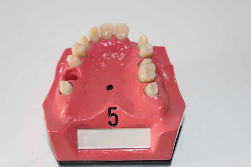 Dent schaumodell 5 - go,