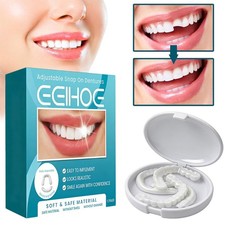 Snap On Veneers Kosmetische