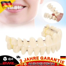 Flex Fit Snap On Veneers