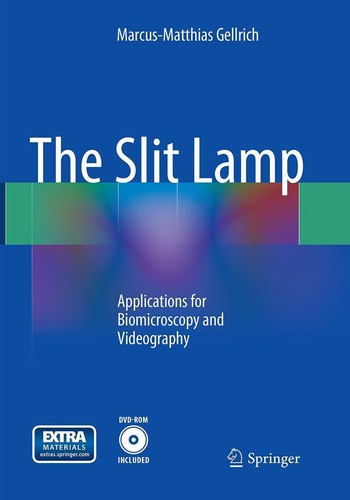 The slit lamp - the, marcus-matthias