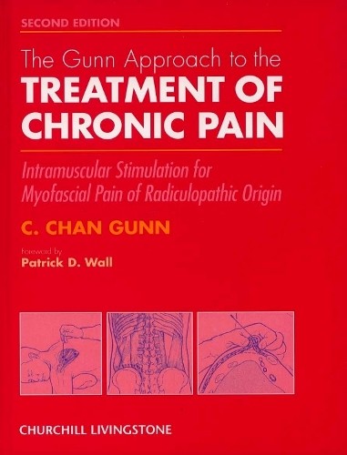 The gunn approach - the,