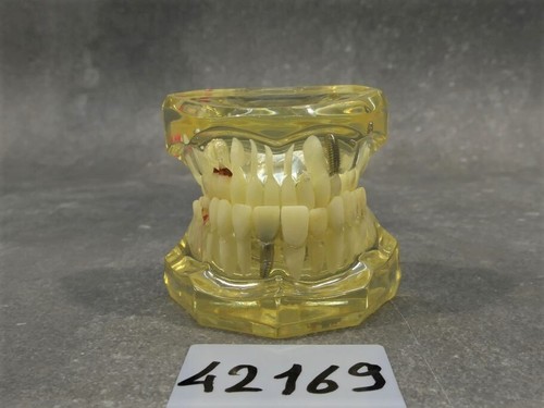 Anotomisches zahnmodell gebiss - anotomisches,