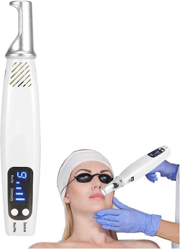 Laser tattoo entferner - laser,