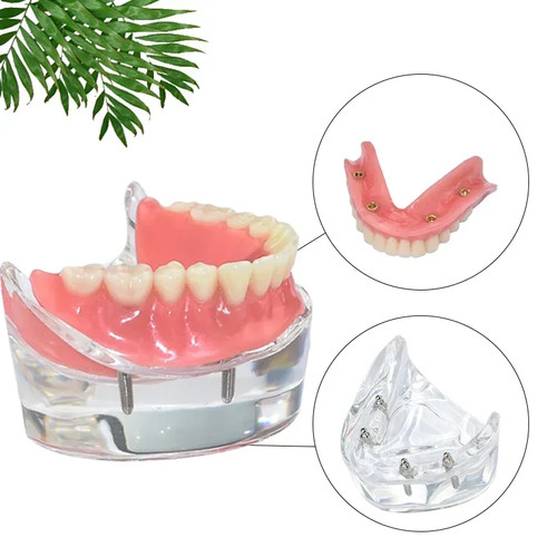 Transparentes zahnmodell mit - zahnmodell, 4
