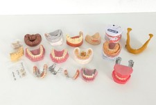 Dental Schaumodelle Zahnarzt Patientenaufklärung Implantate Zahnmodelle