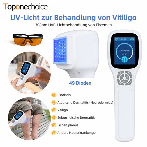308nm uvb lichttherapiegerät - 308nm,
