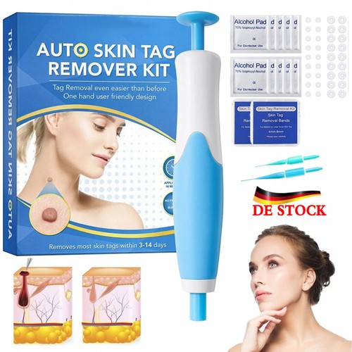 Stielwarzen entferner skin - entferner, tag