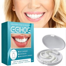 Snap On Veneers Kosmetische