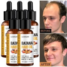 5/3x Batana Öl Für