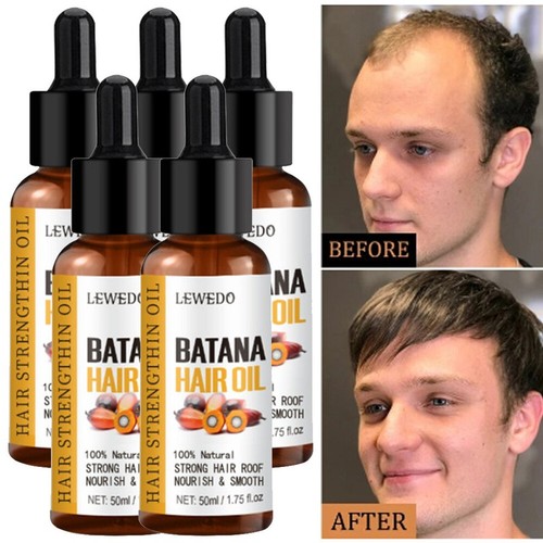 Batana öl für - 5/3x,