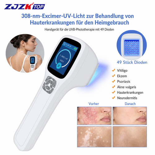 Dioden 308nm uvb - 49,