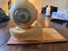 Somso Modell Auge ca. 1920 absolute Rarität - 5fach vergrößert - Original...