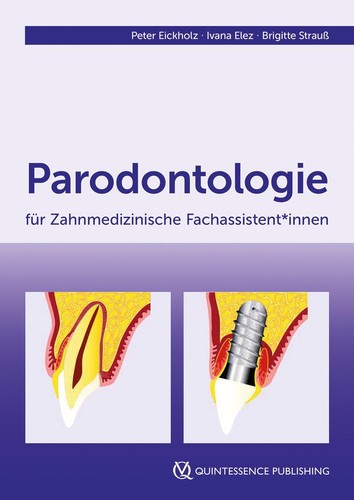 Ivana elez parodontologie - /,