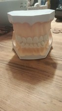 Dental Modell - Zahnmodell- Gips