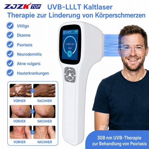 308nm uvb blue lamp - uvb,