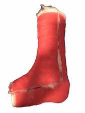 Gipsfuß/bein Cast SLC