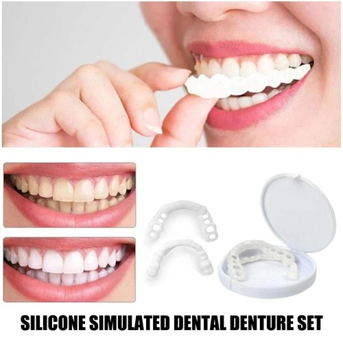Snap veneers kosmetische - snap,