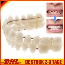 Snap On Veneers Kosmetische