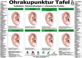 Ohrakupunktur tafel - ohrakupunktur,