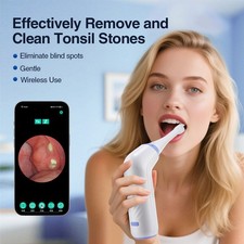 Visible Tonsil Stone Remover