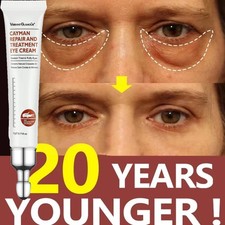 Magic Eye Cream Instant Remove