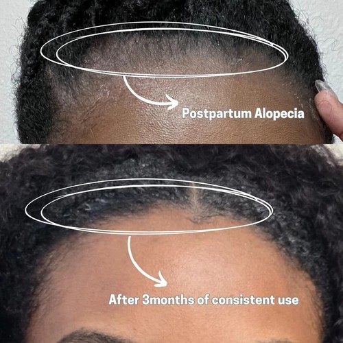 Hair growth oil - growth, grow