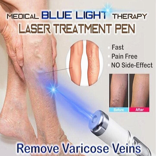 Lcd laser plasma pen mole - plasma,
