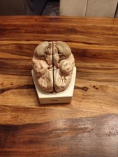 Phywe Anatomisches Modell – Labyrinth, Gehörknöchelchen & Trommelfell – ohr