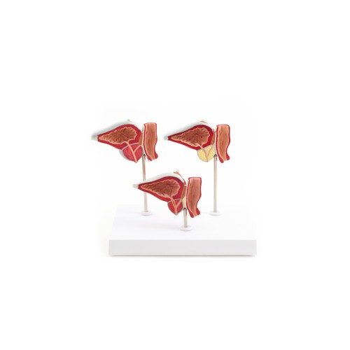 Anatomisches prostata modell - anatomisches, prostata-modell