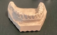 Gebissabdruck Zahnabdruck Gipsabdruck Zahnmodell Kiefer Dental, stabil + sauber,