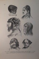 Abbildung Medizin  Anatomie