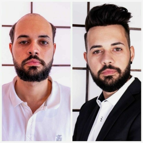 Haarsystem neu perfekt - haarsystem,