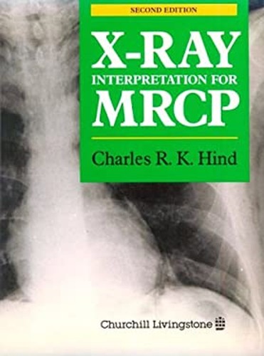 Ray interpretation for - interpretation, mrcp
