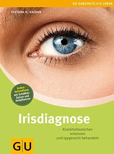 Irisdiagnose